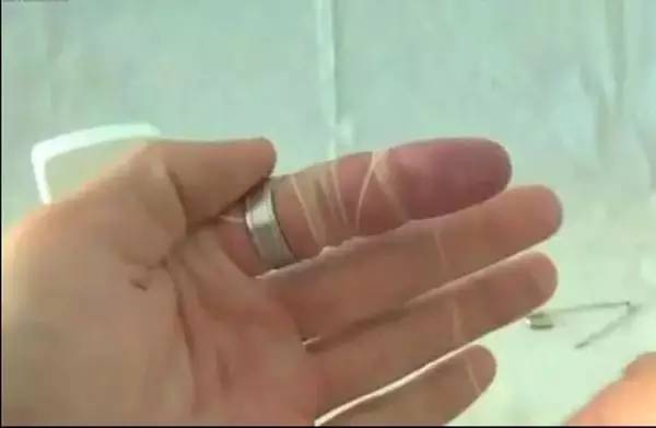 戒指卡停止指